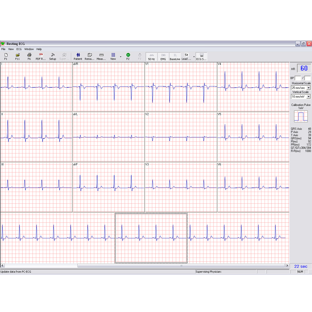 Norav 1200M - PC Based Rust ECG Systeem.