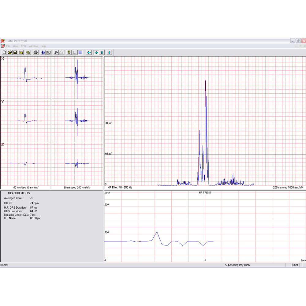 Norav 1200M - PC Based Rust ECG Systeem.