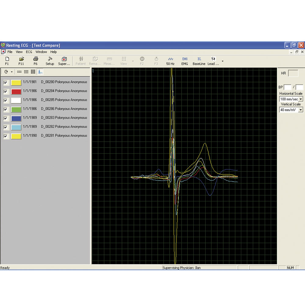 Norav 1200M - PC Based Rust ECG Systeem.