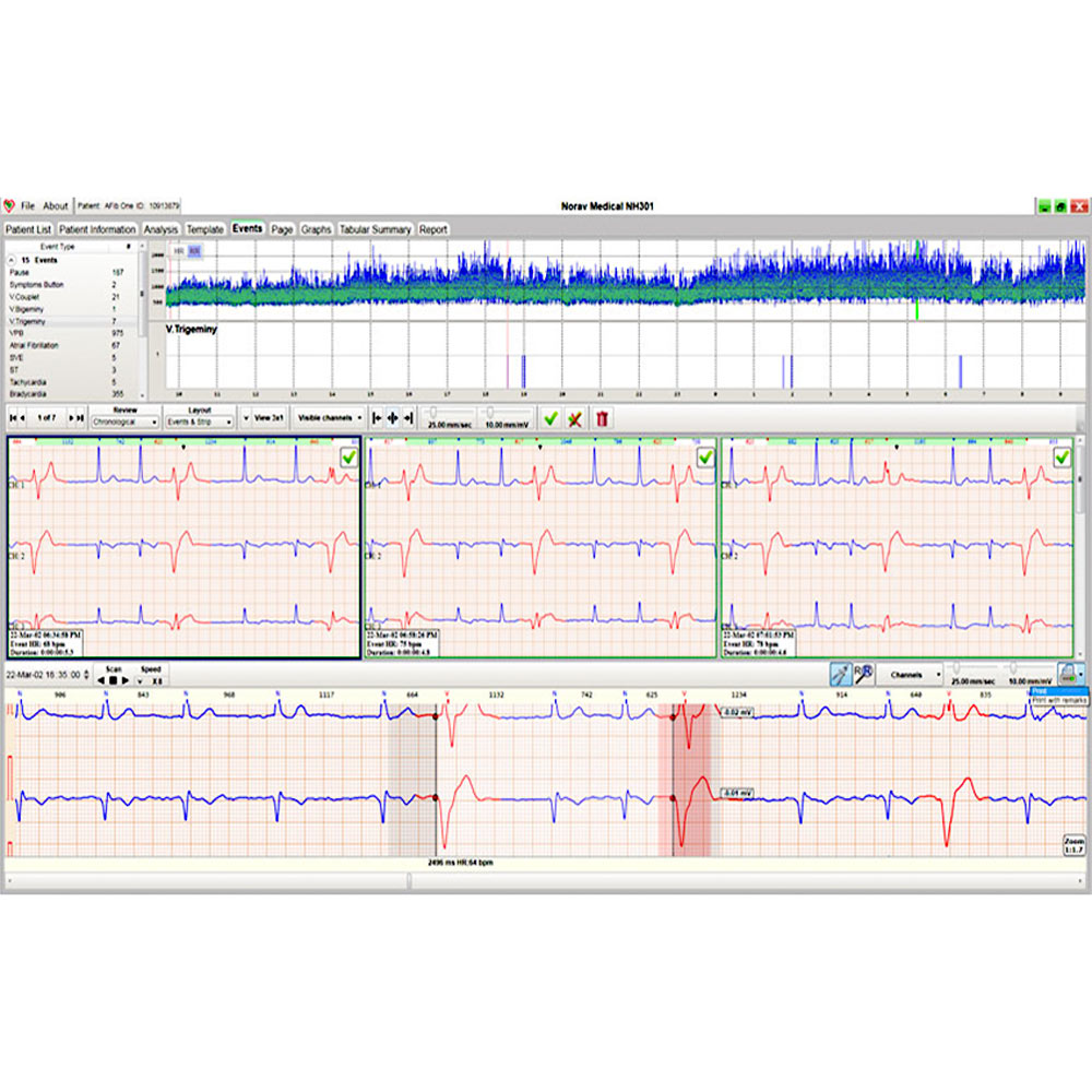 Norav Holter analyse software