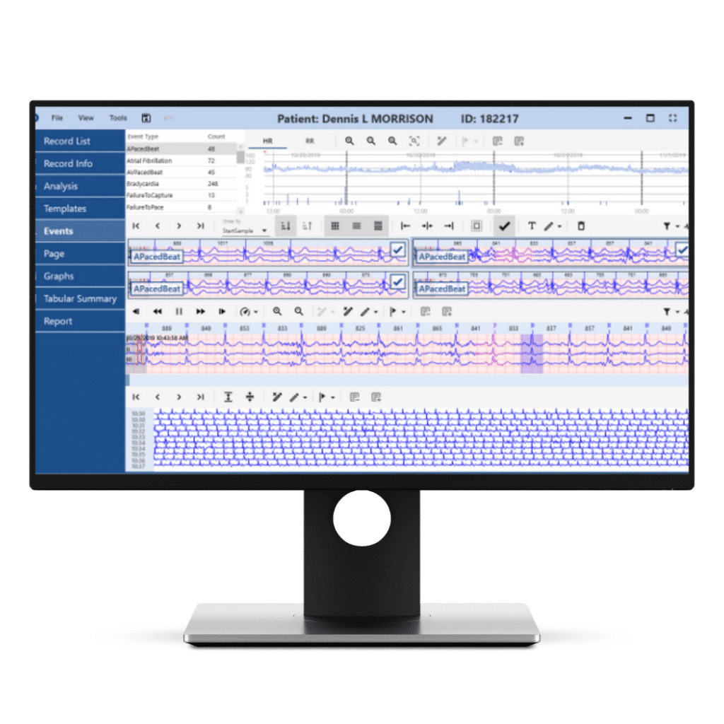 Norav Holter analyse software