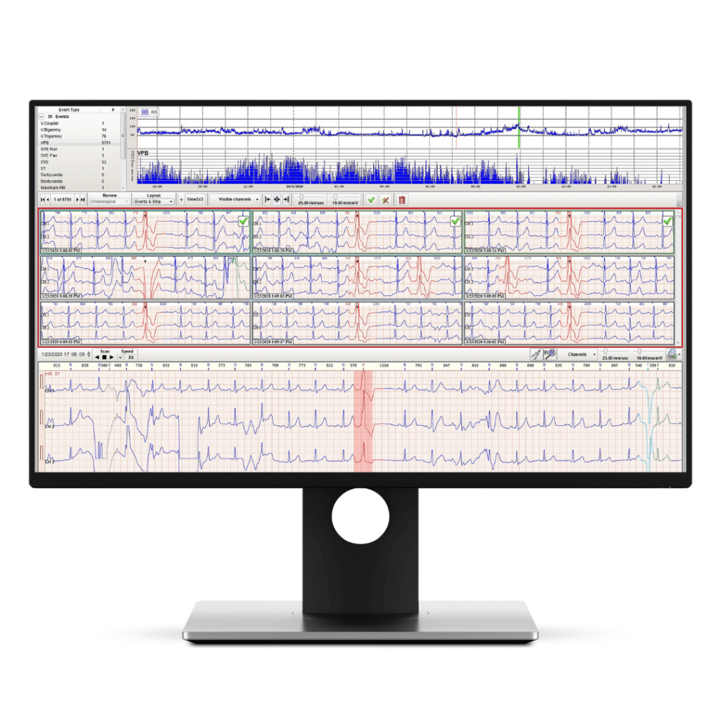 Norav Holter analyse software