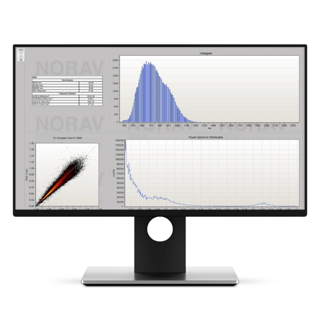 Norav Holter analyse software