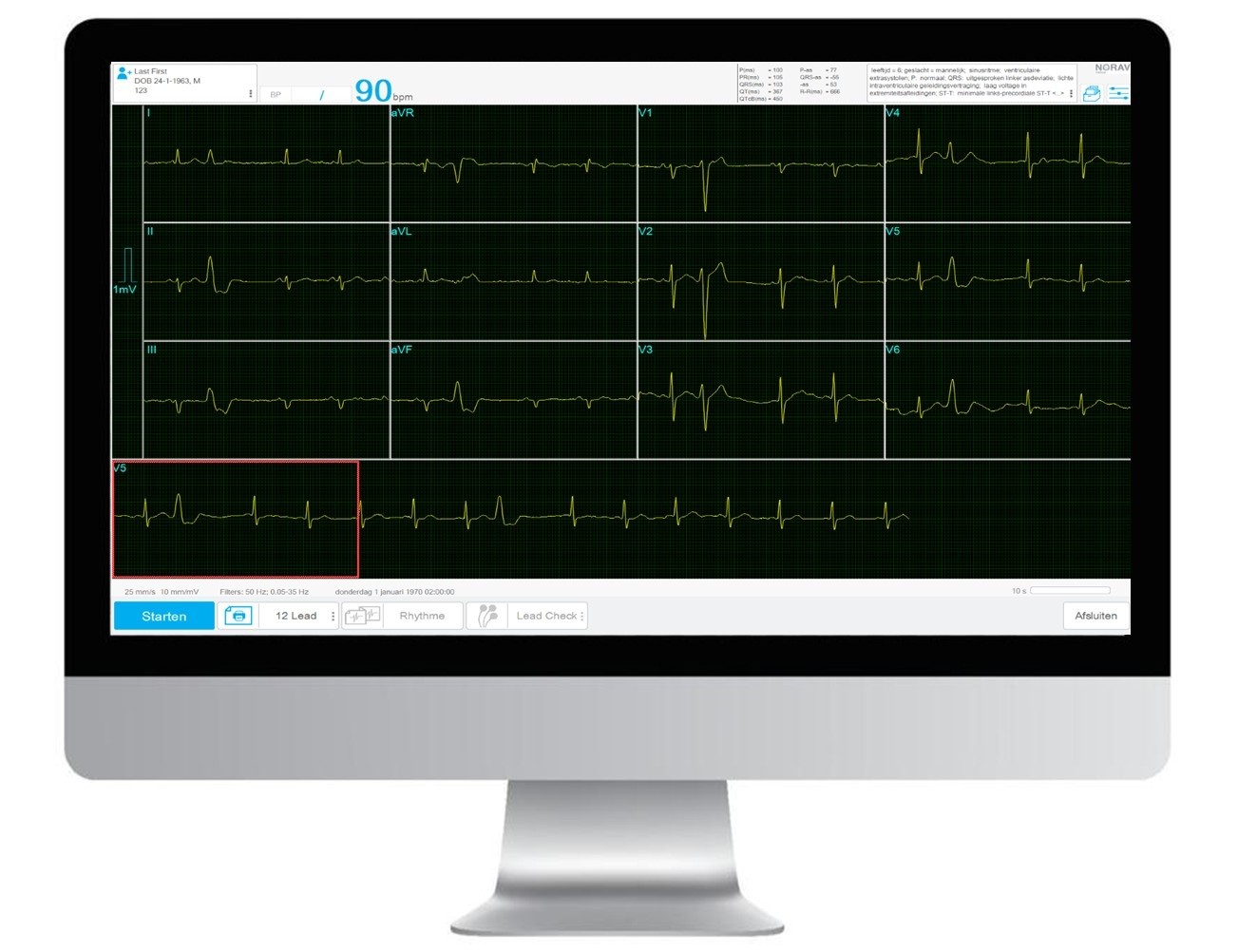 1200HR ECG systeem voor Rust- en inspannings Test