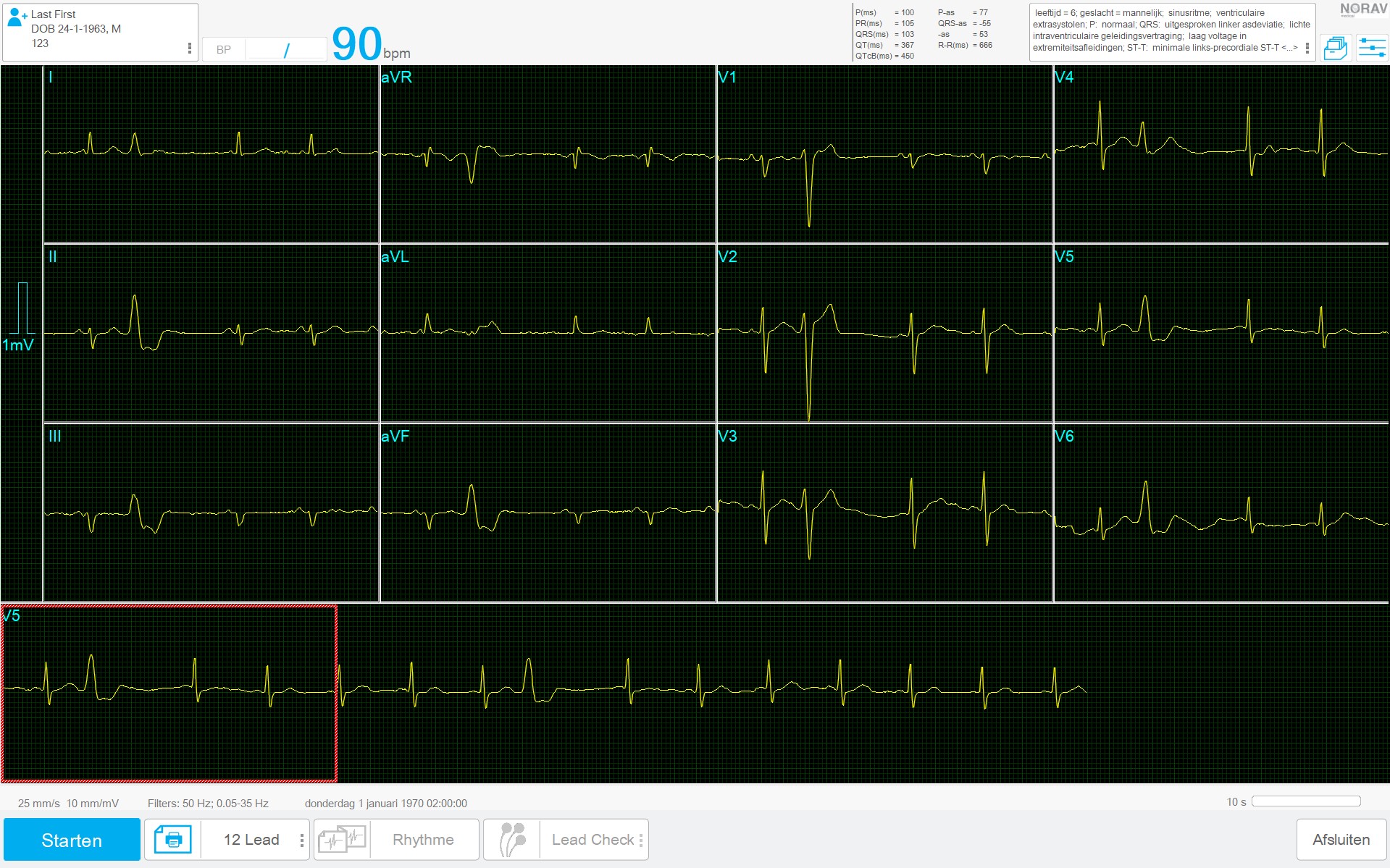 1200HR ECG systeem voor Rust- en inspannings Test