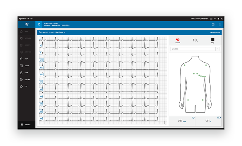 Vitalograph SpiroTrac software